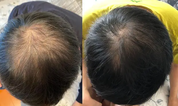 养发加盟怎么样？看乌域“白发转黑”对比图就知道