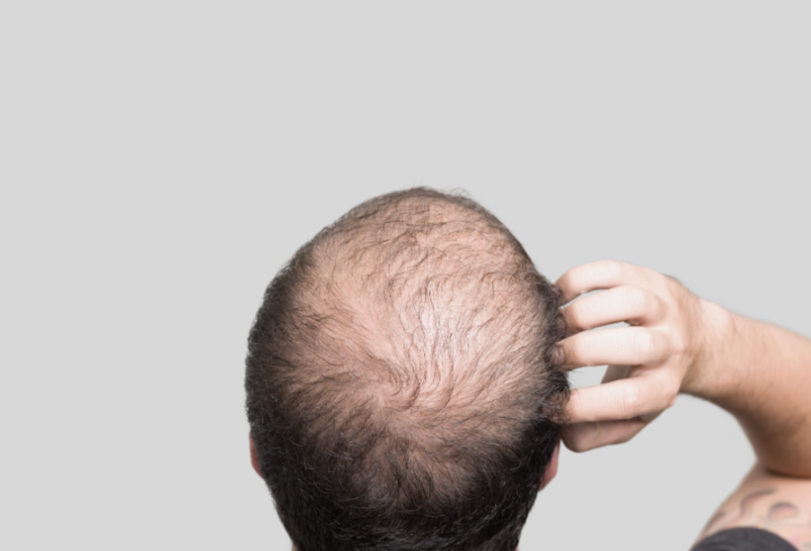 乌域养发加盟前景如何？2026年入局头皮健康市场，这些真相你必须知道！